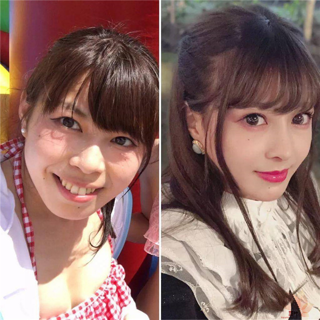小偶像花700万日元整成这样，值吗？